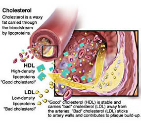 cholesterol 1